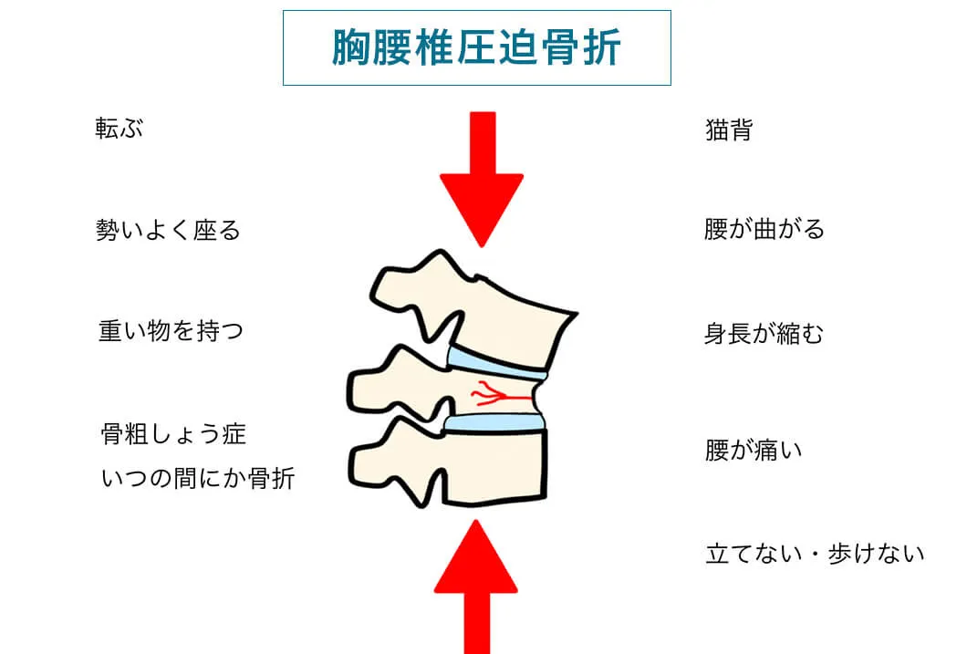 全脊椎の作用と性質 全脊椎の作用と性質 | 黒川瀞雄 |本 | 通販 | Amazon